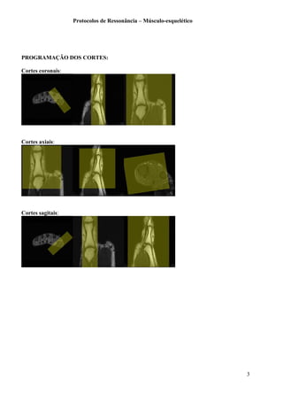 Protocolos de Ressonância – Músculo-esquelético
PROGRAMAÇÃO DOS CORTES:
Cortes coronais:
Cortes axiais:
Cortes sagitais:
3
 