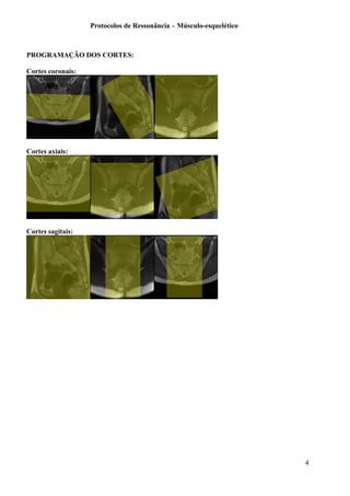 Protocolos de Ressonância – Músculo-esquelético
PROGRAMAÇÃO DOS CORTES:
Cortes coronais:
Cortes axiais:
Cortes sagitais:
4
 