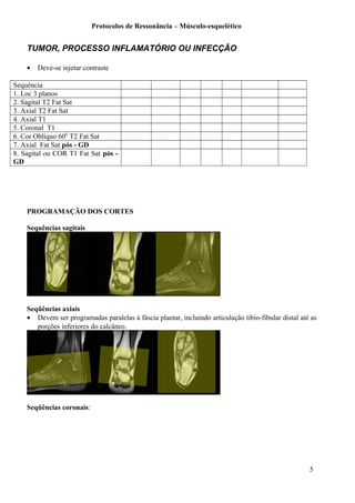 Protocolos de Ressonância – Músculo-esquelético
TUMOR, PROCESSO INFLAMATÓRIO OU INFECÇÃO
• Deve-se injetar contraste
Sequência
1. Loc 3 planos
2. Sagital T2 Fat Sat
3. Axial T2 Fat Sat
4. Axial T1
5. Coronal T1
6. Cor Oblíquo 600
T2 Fat Sat
7. Axial Fat Sat pós - GD
8. Sagital ou COR T1 Fat Sat pós -
GD
PROGRAMAÇÃO DOS CORTES
Sequências sagitais
Seqüências axiais
• Devem ser programadas paralelas à fáscia plantar, incluindo articulação tibio-fibular distal até as
porções inferiores do calcâneo.
Seqüências coronais:
5
 
