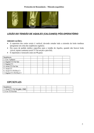 Protocolos de Ressonância – Músculo-esquelético
LESÃO DO TENDÃO DE AQUILES (CALCANEO) PÓS-OPERATÓRIO
OBSERVAÇÕES:
• A espessura dos cortes axiais é variável, devendo estudar toda a extensão da lesão tendínea
(programar em cima das seqüências sagitais);
• Em casos de pedido médico específico para o tendão de Aquiles, quando não houver lesão
visível, injetar contraste (axial T1 Fat sat pré e pós-Gd);
• É importante o tornozelo estar em 90 graus
Seqüência
1. Loc 3 planos
2. Sagital T2 Fat Sat
3. Sagital T1
4. Axial T2 Fat Sat
5. Axial T1
6. Axial T1 FS Pós C+
7. Sagital T1 FS Pós C+
OPCIONAIS
Seqüência
1. Axial T1 Fat Sat pós - Gd)
2. Cor T2 Fat Sat
5
 