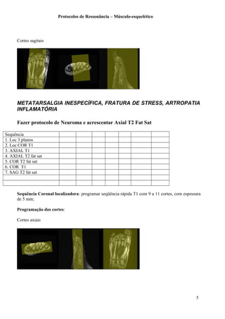 Protocolos de Ressonância – Músculo-esquelético
Cortes sagitais
METATARSALGIA INESPECÍFICA, FRATURA DE STRESS, ARTROPATIA
INFLAMATÓRIA
Fazer protocolo de Neuroma e acrescentar Axial T2 Fat Sat
Sequência
1. Loc 3 planos
2. Loc COR T1
3. AXIAL T1
4. AXIAL T2 fat sat
5. COR T2 fat sat
6. COR T1
7. SAG T2 fat sat
Sequência Coronal localizadora: programar seqüência rápida T1 com 9 a 11 cortes, com espessura
de 5 mm;
Programação dos cortes:
Cortes axiais
5
 