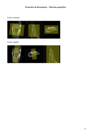 Protocolos de Ressonância – Músculo-esquelético
Cortes coronais
Cortes sagitais
6
 