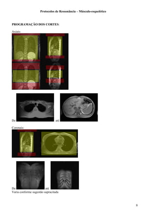 Protocolos de Ressonância – Músculo-esquelético
PROGRAMAÇÃO DOS CORTES:
Axiais:
De até
Coronais:
De até
Varia conforme sugestão supracitada
8
 