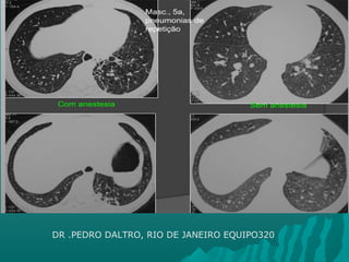 DR .PEDRO DALTRO, RIO DE JANEIRO EQUIPO320
 
