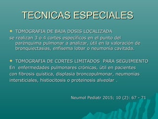 TECNICAS ESPECIALESTECNICAS ESPECIALES
 TOMOGRAFIA DE BAJA DOSIS LOCALIZADATOMOGRAFIA DE BAJA DOSIS LOCALIZADA
se realizan 3 o 4 cortes específicos en el punto delse realizan 3 o 4 cortes específicos en el punto del
parénquima pulmonar a analizar, útil en la valoración deparénquima pulmonar a analizar, útil en la valoración de
bronquiectasias, enfisema lobar o neumonía cavitada.bronquiectasias, enfisema lobar o neumonía cavitada.
 TOMOGRAFIA DE CORTES LIMITADOS PARA SEGUIMIENTOTOMOGRAFIA DE CORTES LIMITADOS PARA SEGUIMIENTO
En enfermedades pulmonares crónicas, útil en pacientesEn enfermedades pulmonares crónicas, útil en pacientes
con fibrosis quística, displasia broncopulmonar, neumoníascon fibrosis quística, displasia broncopulmonar, neumonías
intersticiales, histiocitosis o proteinosis alveolarintersticiales, histiocitosis o proteinosis alveolar ..
Neumol Pediatr 2015; 10 (2): 67 - 71Neumol Pediatr 2015; 10 (2): 67 - 71
 