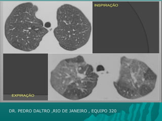 DR. PEDRO DALTRO ,RIO DE JANEIRO , EQUIPO 320
 