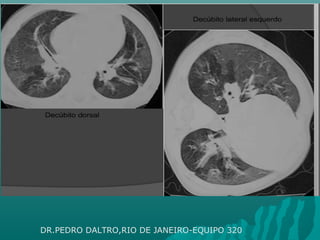 DR.PEDRO DALTRO,RIO DE JANEIRO-EQUIPO 320
 