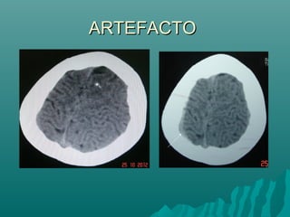 ARTEFACTOARTEFACTO
 