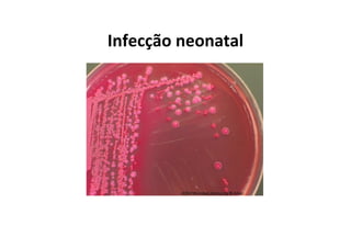 Infecção neonatal
 