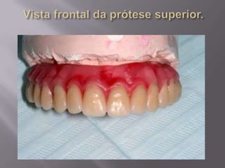 Protocolo superior e inferior.