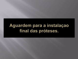 Protocolo superior e inferior.