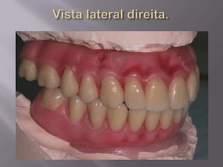 Protocolo superior e inferior.