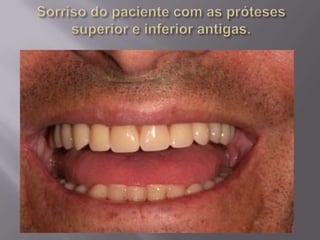 Protocolo superior e inferior.