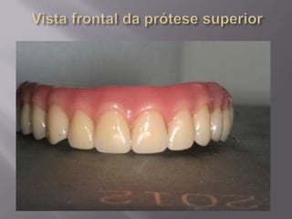 Protocolo superior e inferior.