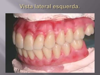 Protocolo superior e inferior.