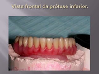 Protocolo superior e inferior.