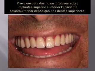 Protocolo superior e inferior.