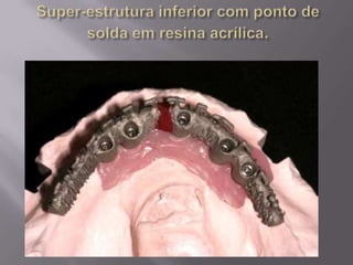 Protocolo superior e inferior.