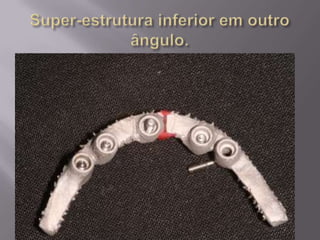 Protocolo superior e inferior.