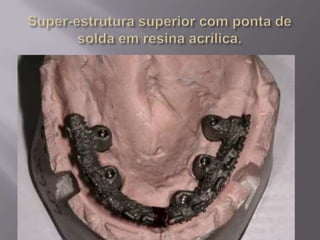 Protocolo superior e inferior.