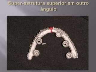 Protocolo superior e inferior.