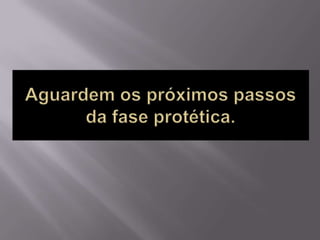 Protocolo superior e inferior.