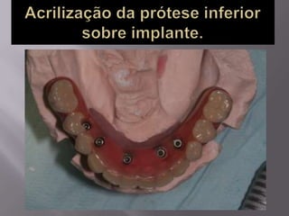 Protocolo superior e inferior.