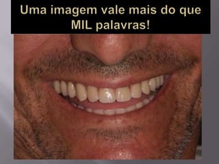 Protocolo superior e inferior.