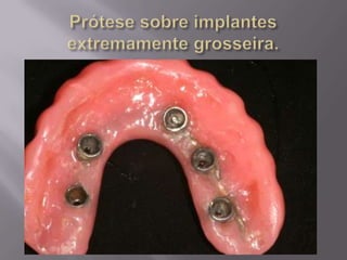 Protocolo superior e inferior.