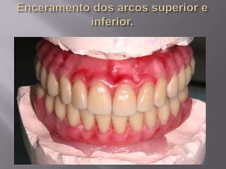 Protocolo superior e inferior.