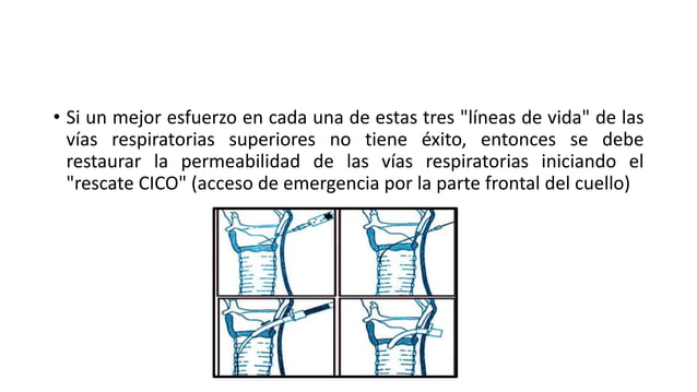 Protocolo vortex.pptx