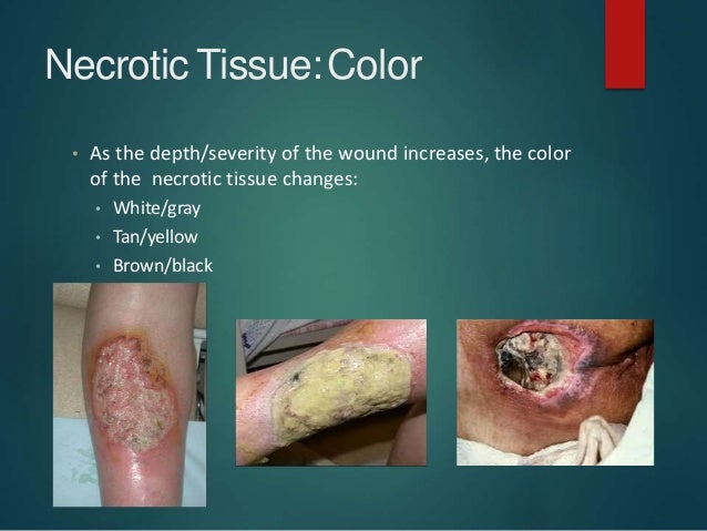 Protocols Of Wound Debridement