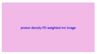 proton density PD weighted mri image
 