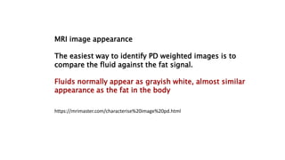 MRI image appearance
The easiest way to identify PD weighted images is to
compare the fluid against the fat signal.
Fluids normally appear as grayish white, almost similar
appearance as the fat in the body
https://mrimaster.com/characterise%20image%20pd.html
 