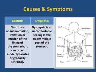 Causes & Symptoms
Gastritis Dyspepsia
Gastritis is
an inflammation,
irritation or
erosion of the
lining of
the stomach. It
can occur
suddenly (acute)
or gradually
(chronic).
Dyspepsia is an
uncomfortable
feeling in the
upper middle
part of the
stomach.
 