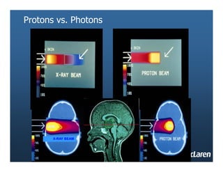 PROTON THERAPY THAT WILL COMING IN OUR COUNTRY | PDF