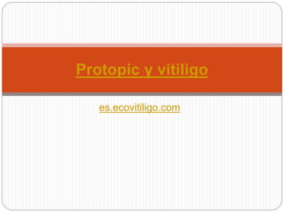 es.ecovitiligo.com
Protopic y vitiligo
 