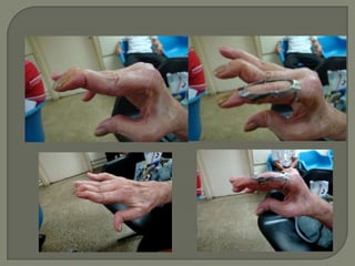 IEA - Protótipos e projetos em tecnologia assistiva Prof.ª Valéria