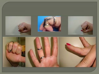 IEA - Protótipos e projetos em tecnologia assistiva Prof.ª Valéria