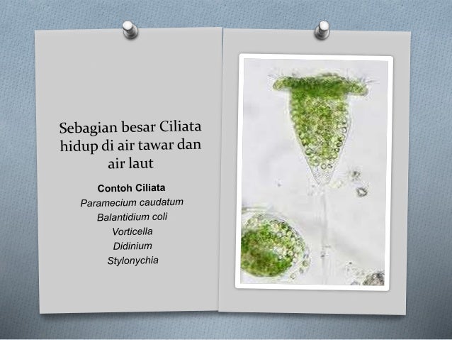 Protista (protozoa,alga,jamur protista)