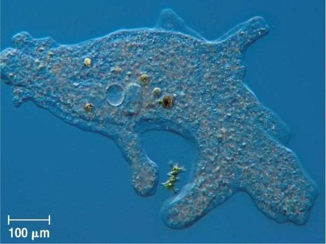 protozoa