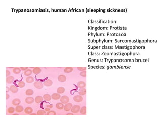 Trypanosomiasis, human African (sleeping sickness)
Classification:
Kingdom: Protista
Phylum: Protozoa
Subphylum: Sarcomastigophora
Super class: Mastigophora
Class: Zoomastigophora
Genus: Trypanosoma brucei
Species: gambiense
 
