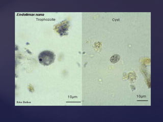 Protozoan Insecticide Protozoan parasites | PDF