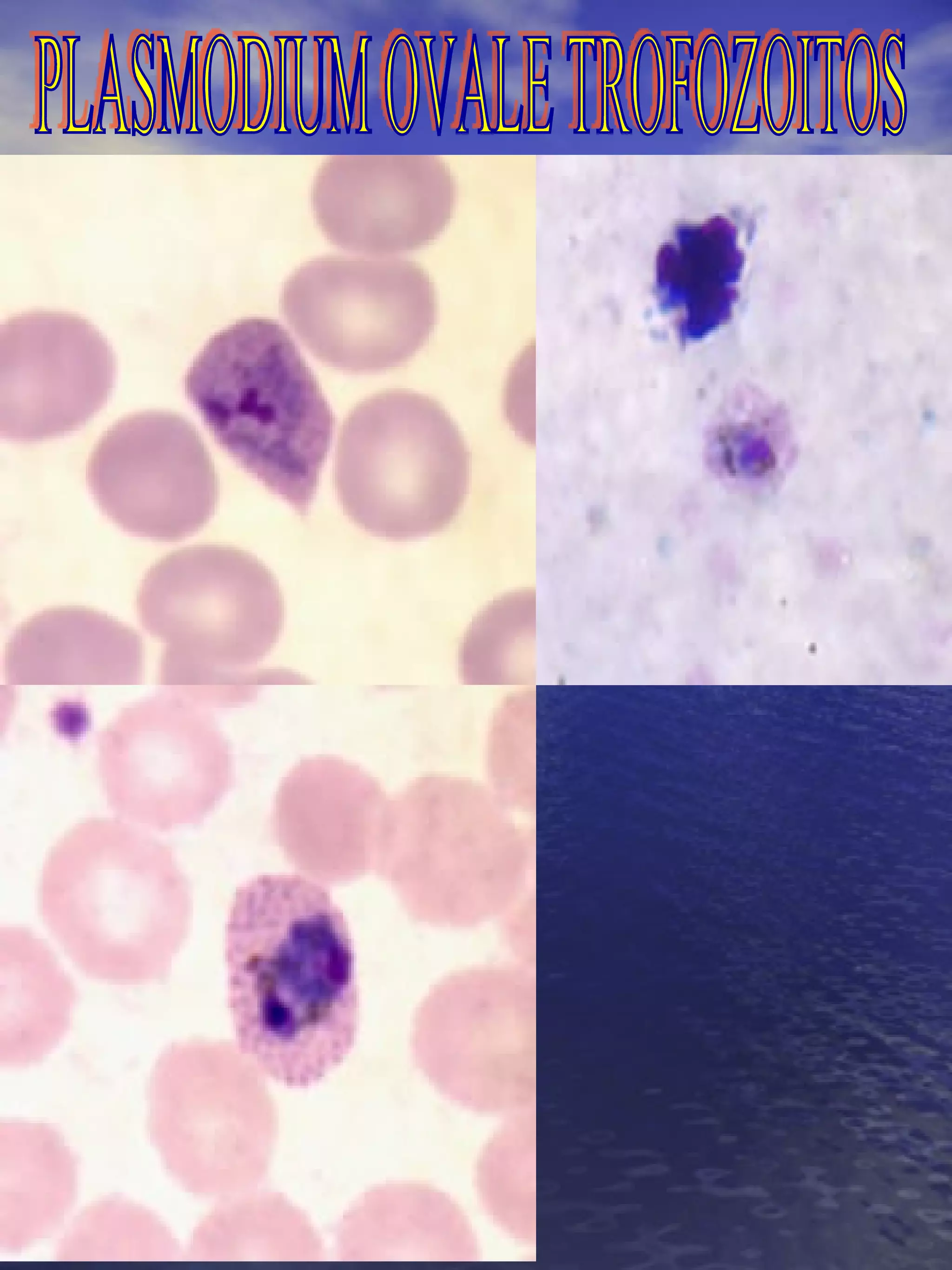 PLASMODIUM OVALE TROFOZOITOS 