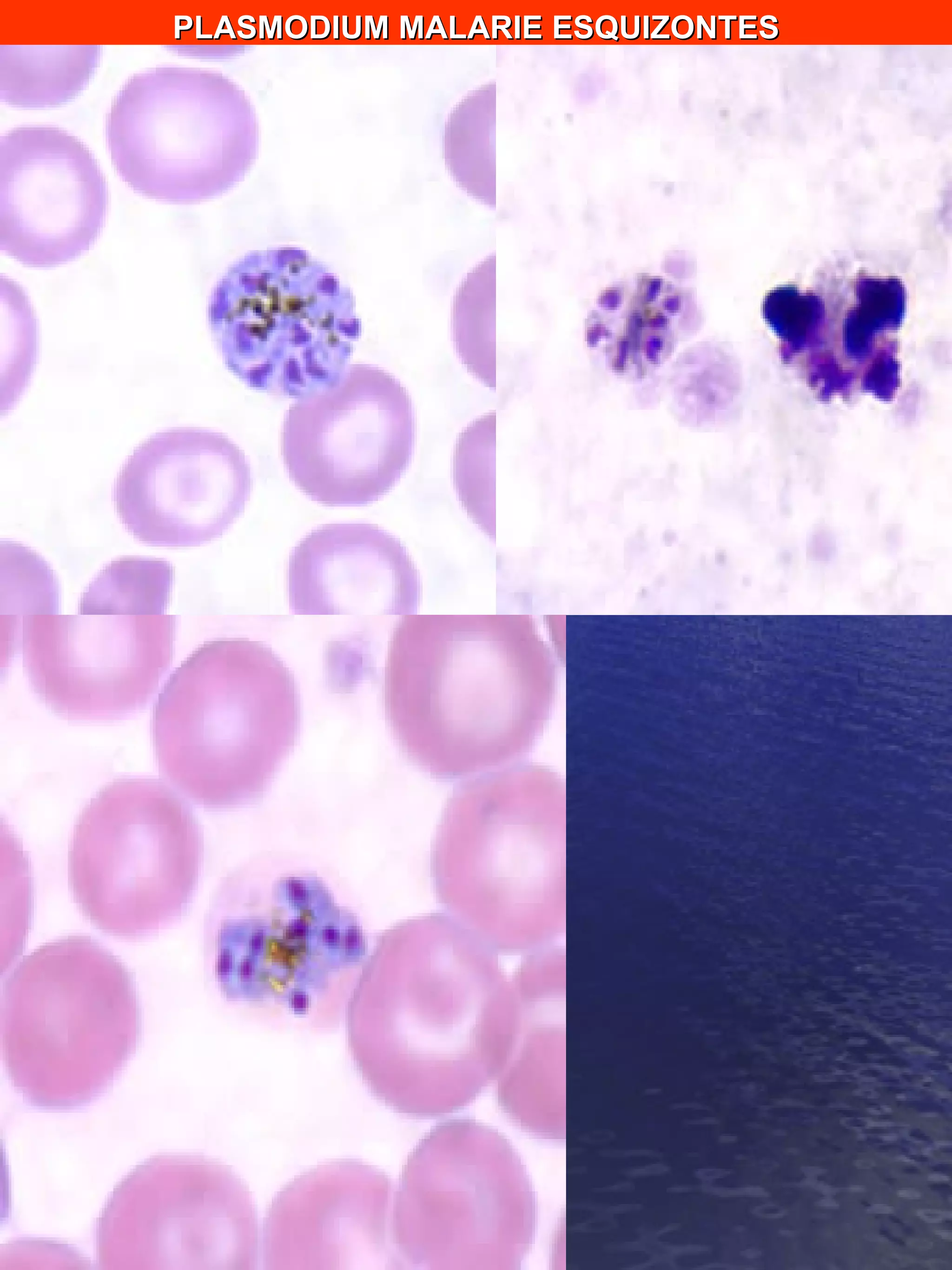 PLASMODIUM MALARIE ESQUIZONTES 