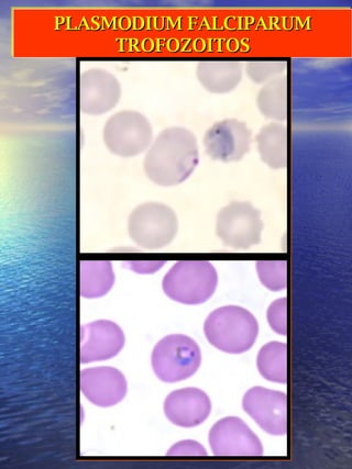 PLASMODIUM FALCIPARUM TROFOZOITOS 