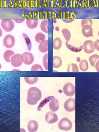 PLASMODIUM FALCIPARUM GAMETOCITOS 
