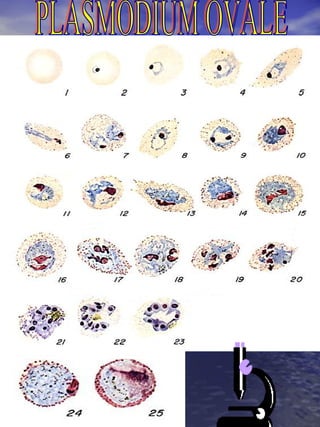 PLASMODIUM OVALE 
