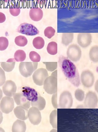 PLASMODIUM OVALE ESQUIZONTES 