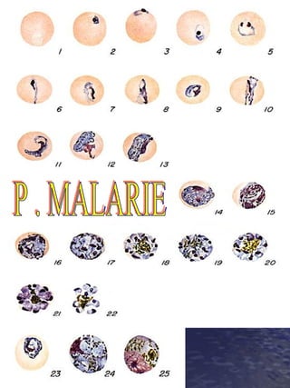 P . MALARIE 